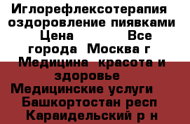 Иглорефлексотерапия, оздоровление пиявками › Цена ­ 3 000 - Все города, Москва г. Медицина, красота и здоровье » Медицинские услуги   . Башкортостан респ.,Караидельский р-н